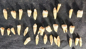 Rare Antique Human Teeth W Roots I Tooth Molar Bicuspids 25 Remain