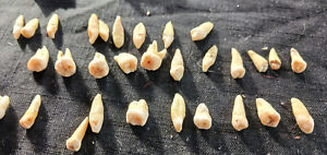 Rare Antique Human Tooth Teeth W Roots I Tooth Molar Bicuspids 24 Getting Fewer